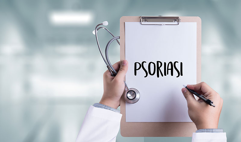 psoriasi