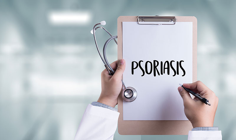 psoriasis