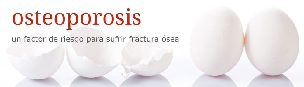 Osteoporosi: un factor de risc per patir fractura òssia