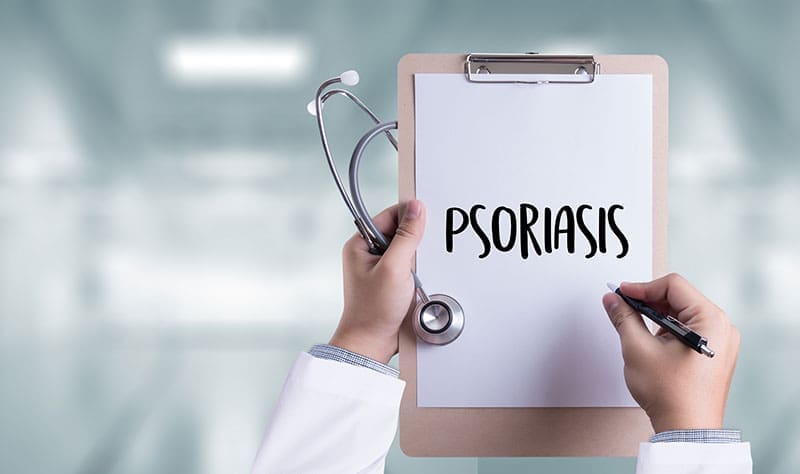 Psoriasi, una malaltia que afecta més d’un milió de persones a Espanya