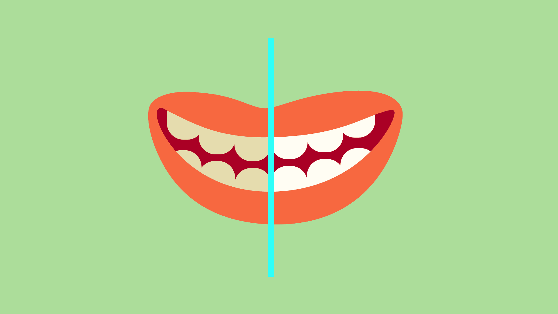 Tratamientos de estética dental: el blanqueamiento dental