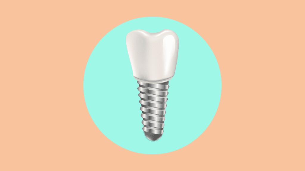 Los implantes dentales