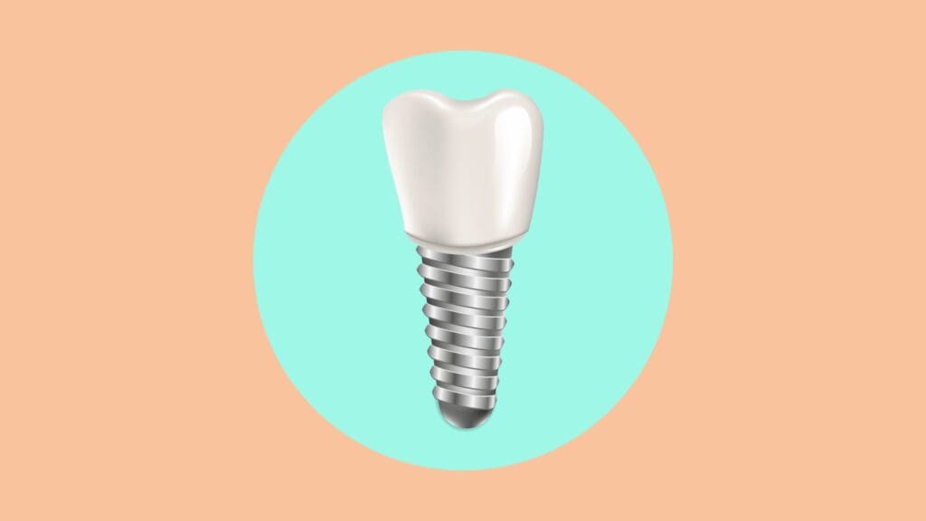 Els implants dentals