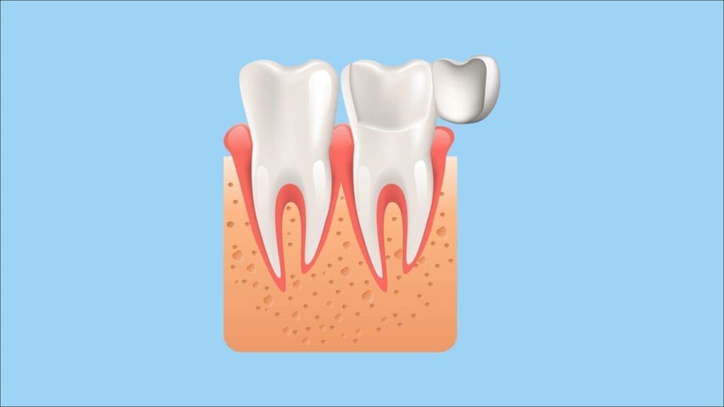 Tractaments d’estètica dental: les facetes dentals